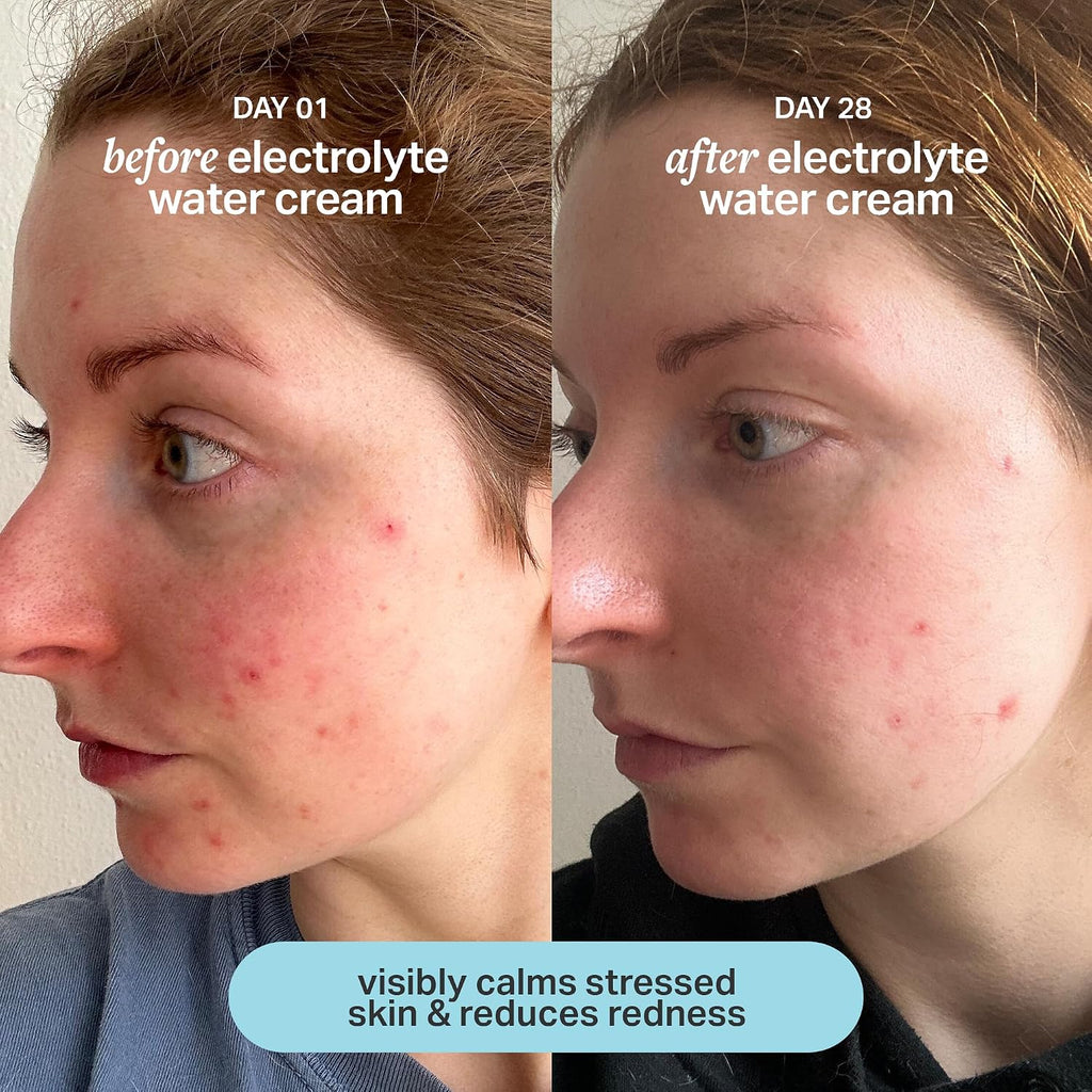 Electrolyte Water Cream | Lightweight Water Gel Moisturizer | Balanced Hydrating Day Cream for All Skin Types | 1.7 Fl Oz | Lightweight Water Gel Moisturizer, Balanced Hydrating Day Cream for All Skin Types, Facial Moisturizing Cream